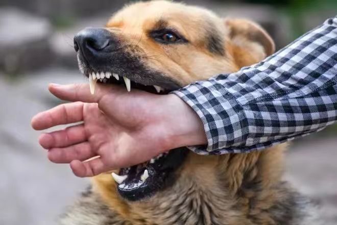 被宠物抓伤是否会得狂犬病? 专家解答建议尊重当事人意愿